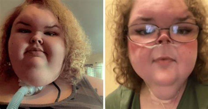 Allison Rosati Bio, Weight Loss, Salary, Net Worth