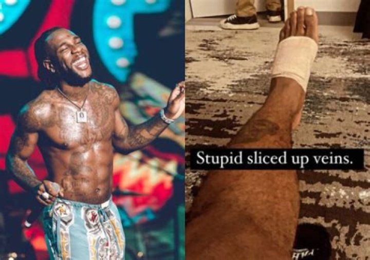 
Burna Boy Performs ‘Last Last’ With ‘One Leg,’ Shades Colleagues 