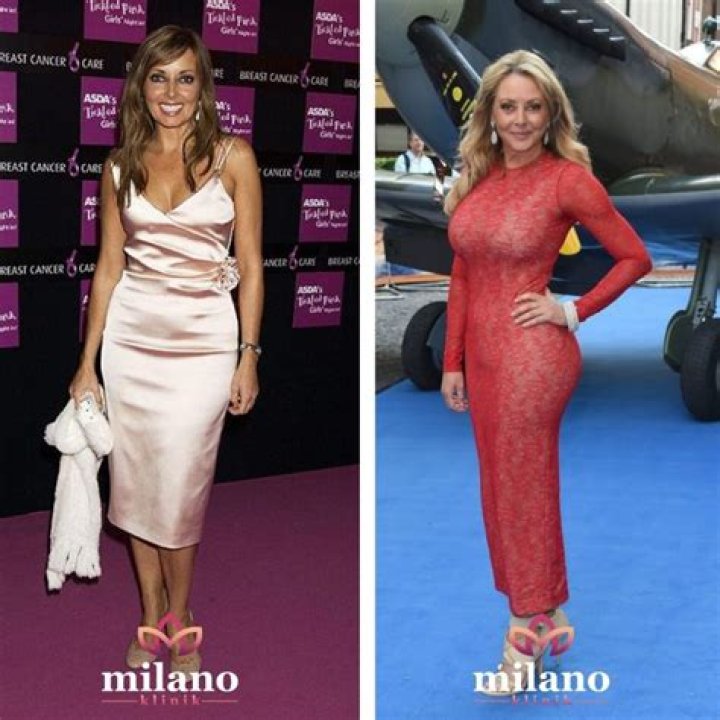 Carol Vorderman Unsuccessful Marriage Life & Successful Plastic Surgery