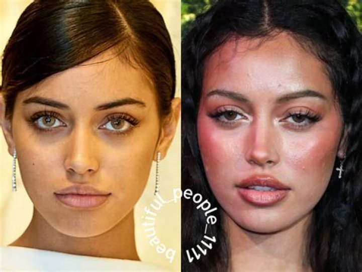 Cindy Kimberly Nose Job, Plastic Surgery, Age, Height, Instagram, Net Worth