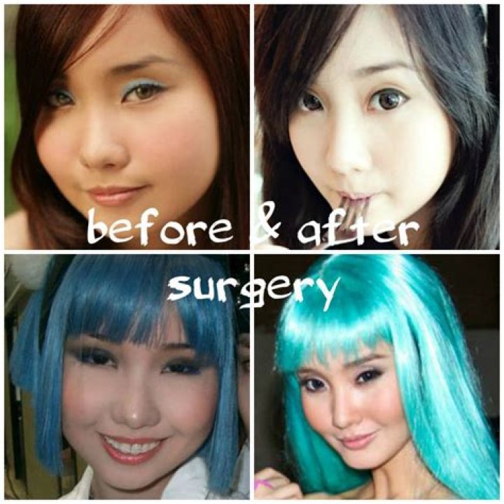 Did Cosplay Star Alodia Gosiengfiao Ever Do Plastic Surgery? Before And After Face Pictures