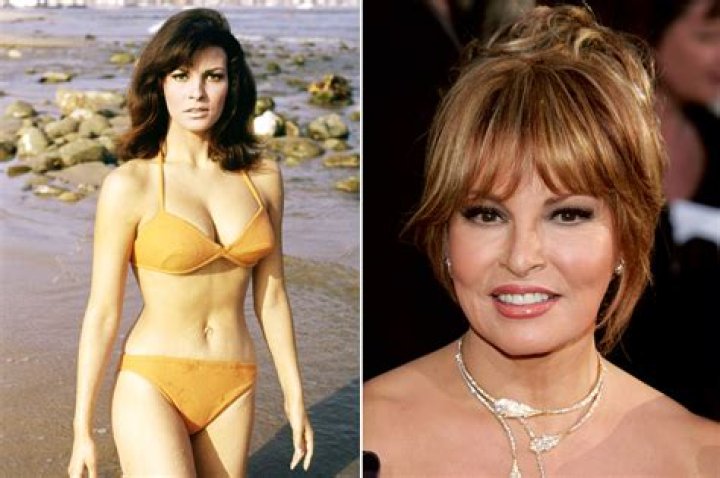 Did Raquel Welch Have A Depression? Illness And Health Before Death
