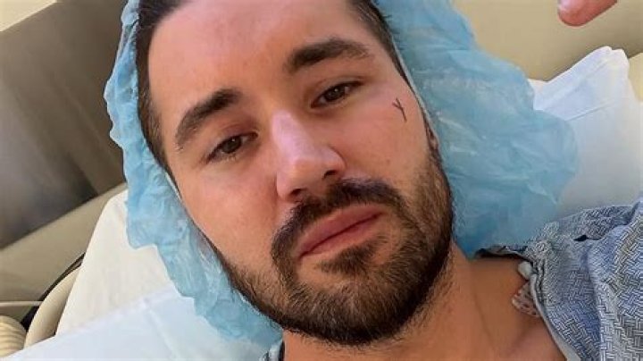 
Does Jeff Wittek Have A Glass Eye? Injury Of Eyes And Surgery Update In 2022 