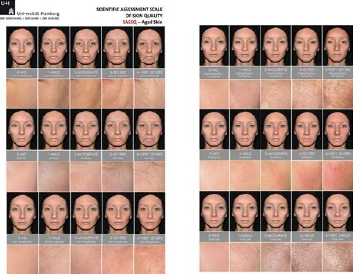 Everything On BBC’s Hywel Griffiths Face and Skin Condition – Does Hywel Griffith Have A Cancer?