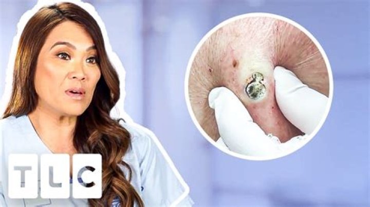Everything To Learn About Dr Pimple Popper’s Husband, Jeffrey Rebish