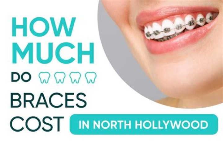 How much does western dental charge for braces