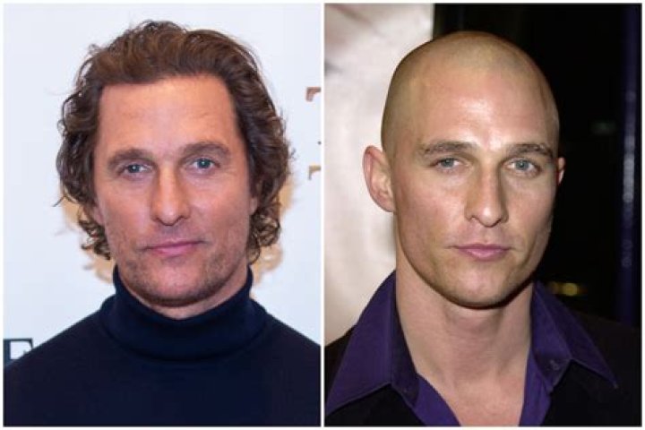 Is Matthew McConaughey Balding? Actor Provides Details On His Hair Transformation