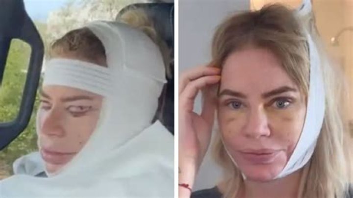 Real House Wives Of Dubai: Caroline Stanbury Before And After Plastic Surgery Pictures