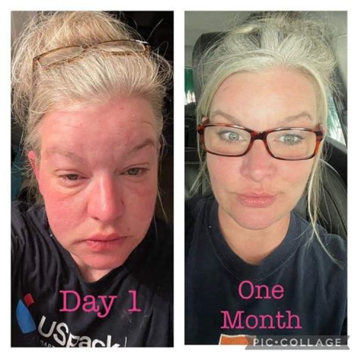 
Sue Cleaver Weight Loss: Her Diet Includes Alcohol, Before And After 