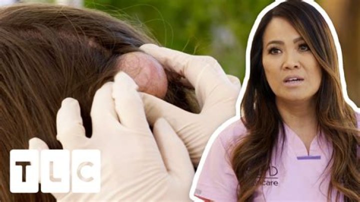 
What Happened To Kevin Olaeta? Dr Pimple Popper Patient Passed Away 