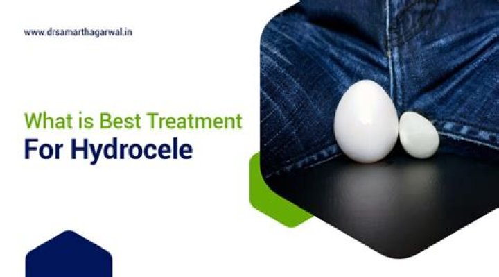 What is the best treatment for hydrocele