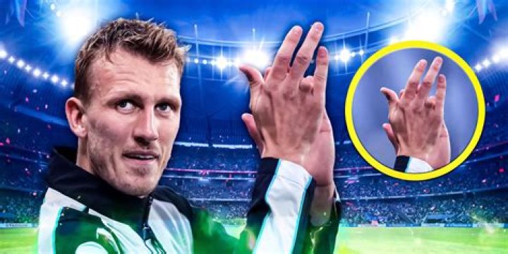 
Why Is Dan Burn Missing a Finger? Heres What Happened To The Premier League Footballer 